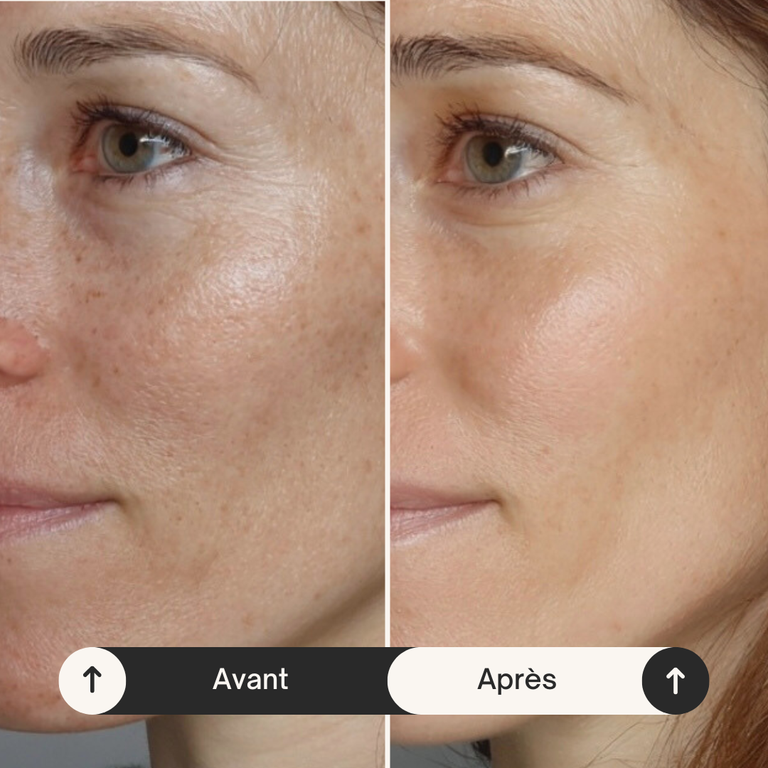 Sérum Éclat 24K à la Niacinamide