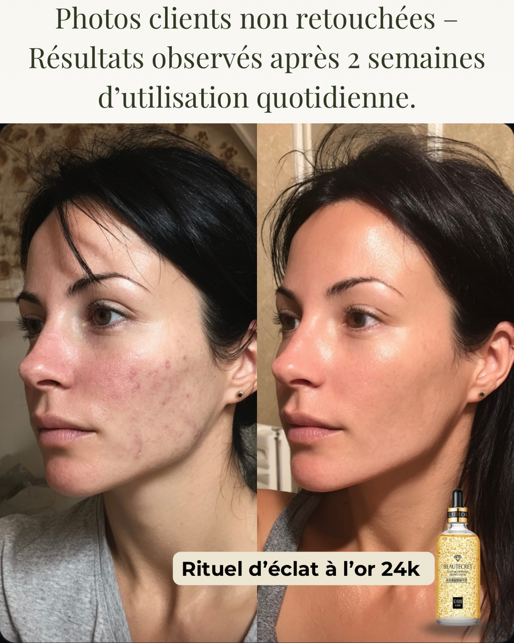 Sérum Éclat 24K à la Niacinamide
