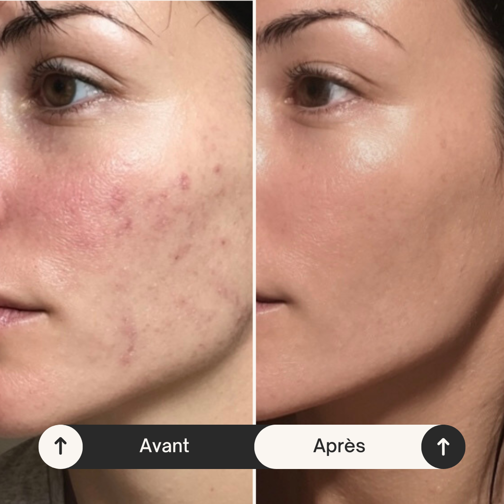 Lotion Tonique Éclat 24K – Niacinamide & Or Pur 300ml