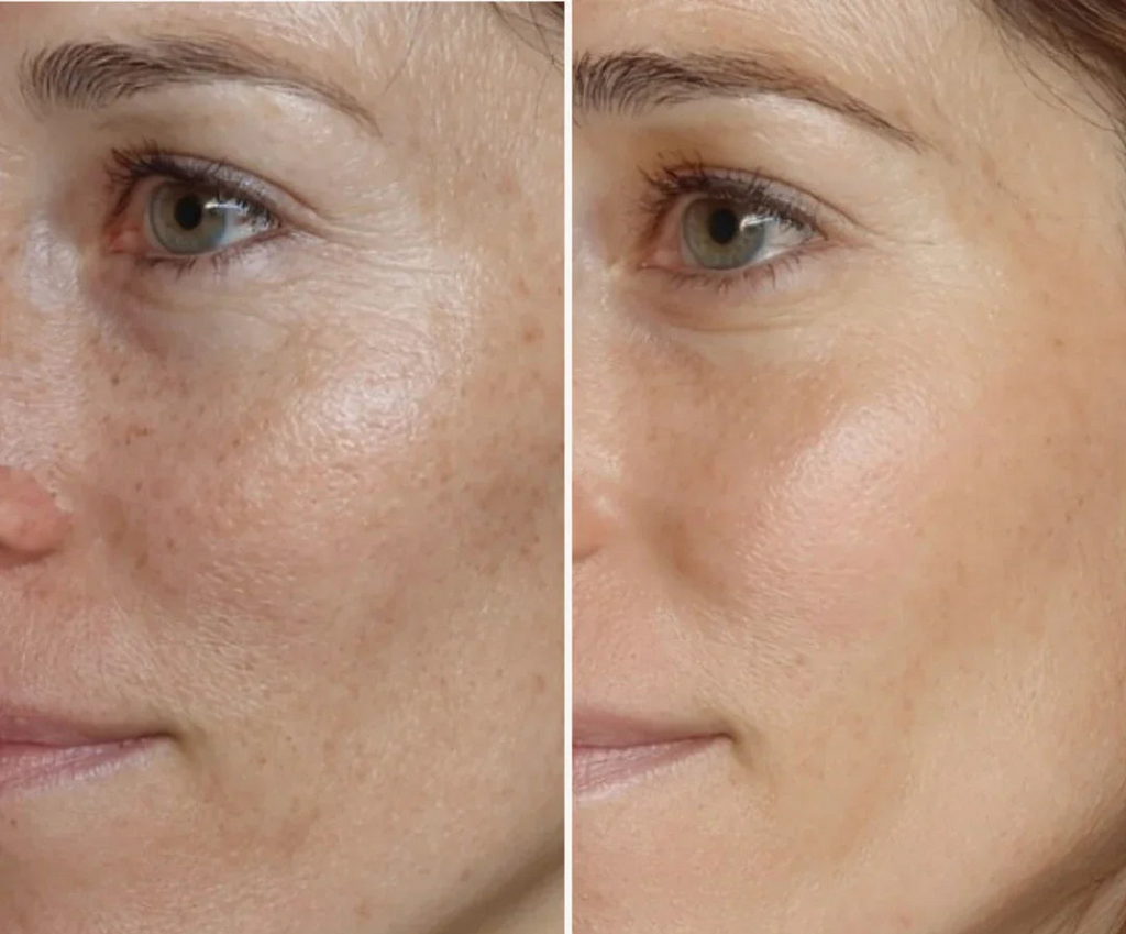 Coffret Soin Visage Anti-Âge à l’Or 24K – Éclat, Hydratation & Fermeté